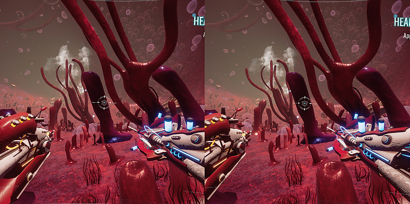 Project Remedium VR